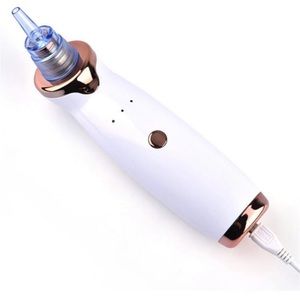 Blackheads whiteheads remover